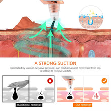 USB Rechargeable Blackhead Remover Vacuum