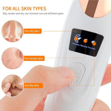 USB Rechargeable Blackhead Remover Vacuum